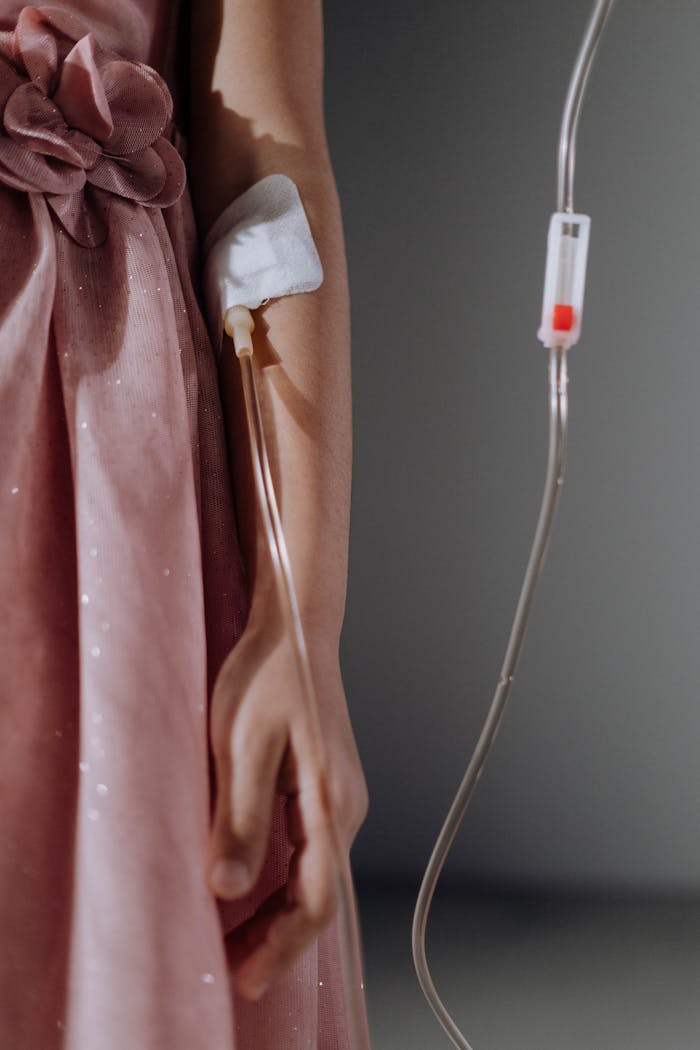 Close-up shot of a woman in a dress receiving intravenous therapy through her arm.